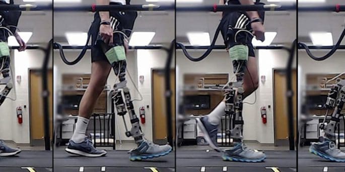 Prótesis robótica de pierna